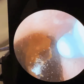 Higien™ Ear Cleaner with Camera