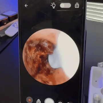Higien™ Ear Cleaner with Camera